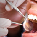 dental check